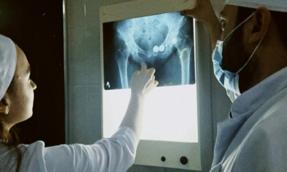 Mandata in due posti diversi per una radiografia alle anche: una per la destra e uno per la sinistra