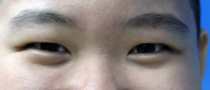 Il sistema di allerta affaticamento dell’auto continua a richiamarlo, ma lui ha soltanto… gli occhi a mandorla