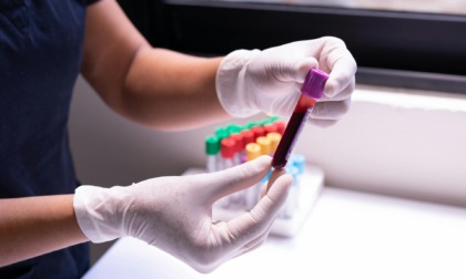 La donna che a 31 anni ha il sangue di un neonato