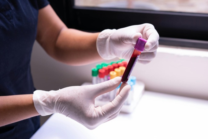 La donna che a 31 anni ha il sangue di un neonato